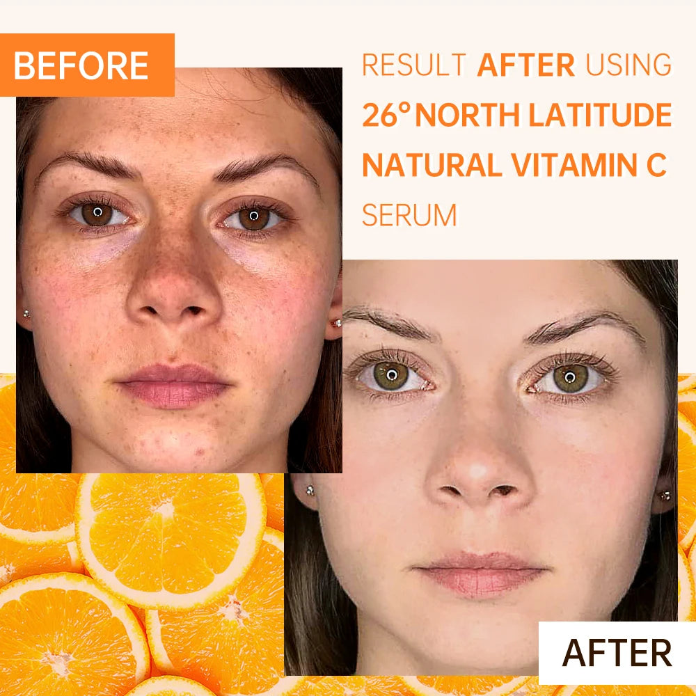 Amazing Vitamin C Full Skin Care Set LUXLIFE BRANDS