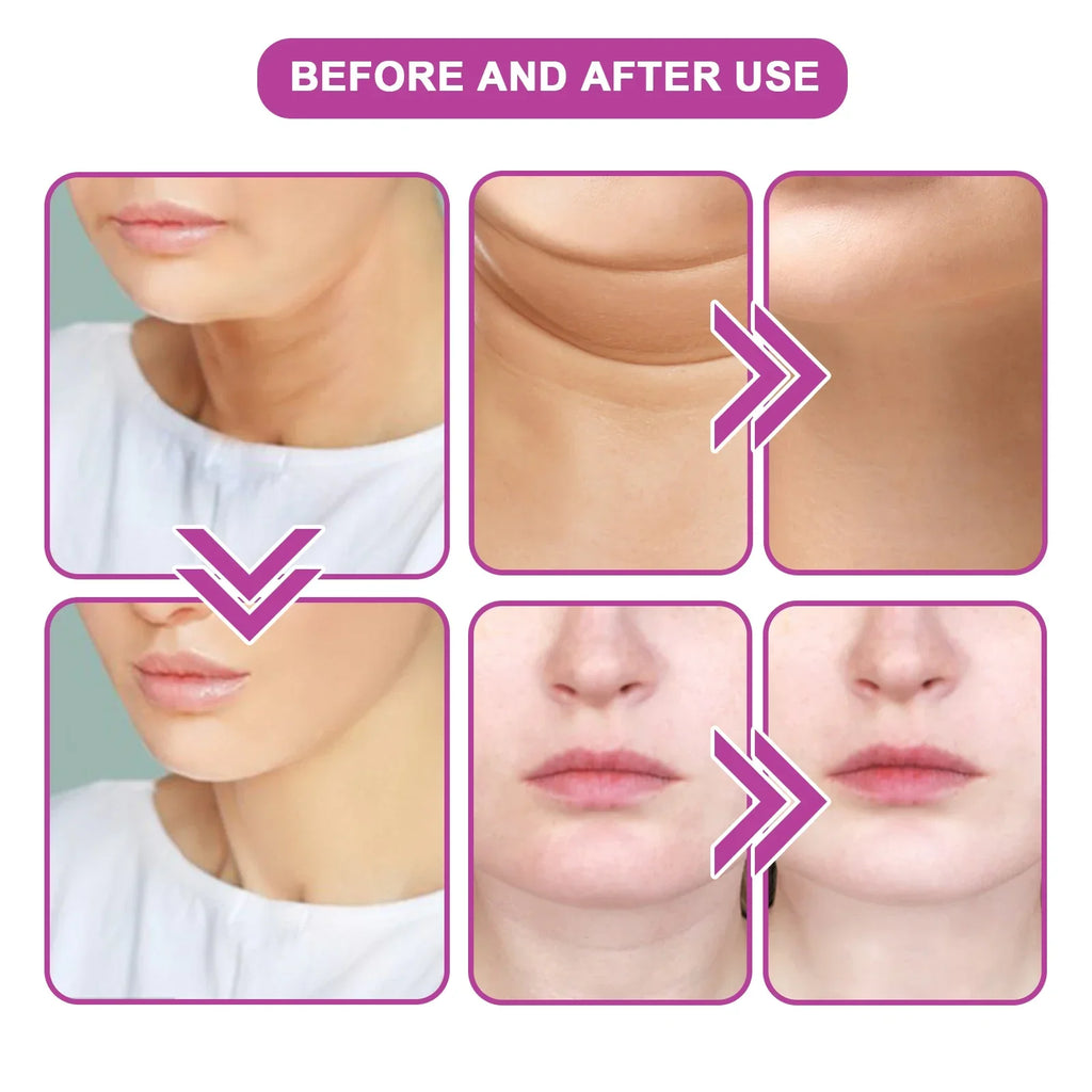 20ML Neck Tightening Cream Neck Massage Cream Reduce Neck Wrinkles Lift And Moisturize Smooth Skin & Provide Neck Care Product