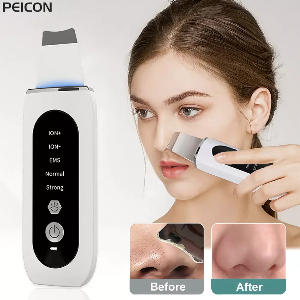 Ultrasonic Skin Scrubber LUXLIFE BRANDS