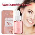 Dark Spots Corrector 30ml Niacinamide Serum Luxlife Brands