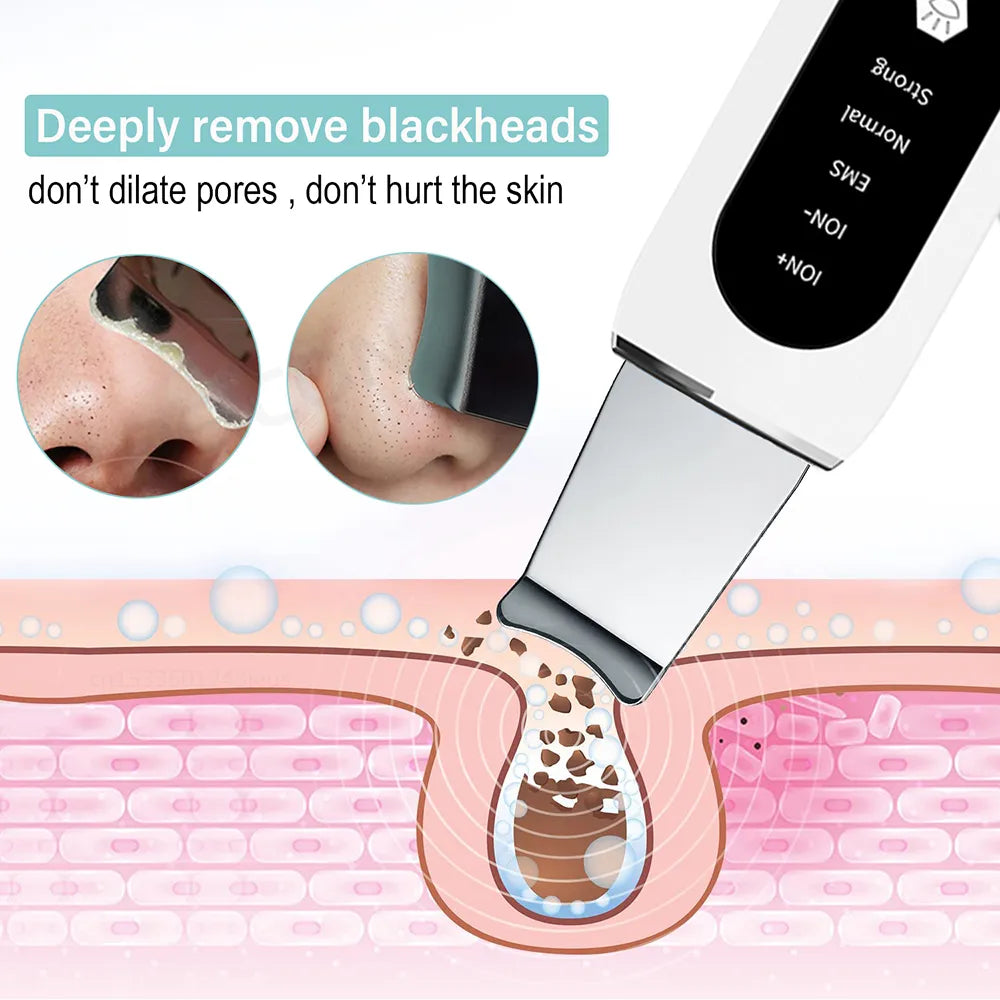 Ultrasonic Skin Scrubber Peeling Blackhead Remover Deep Face Cleaning Ultrasonic Ion Ance Pore Cleaner Facial Shovel Cleanser