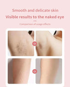 Lux Woman’s Electric Bikini Hair Remover Luxlife Brands