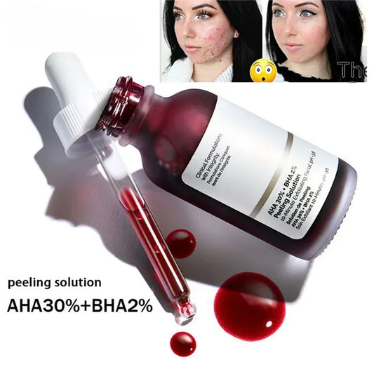 acid AHA 30% + BHA 2% exfoliating liquid facial essence salicylic acid moisturizing facial skin care products 30ml