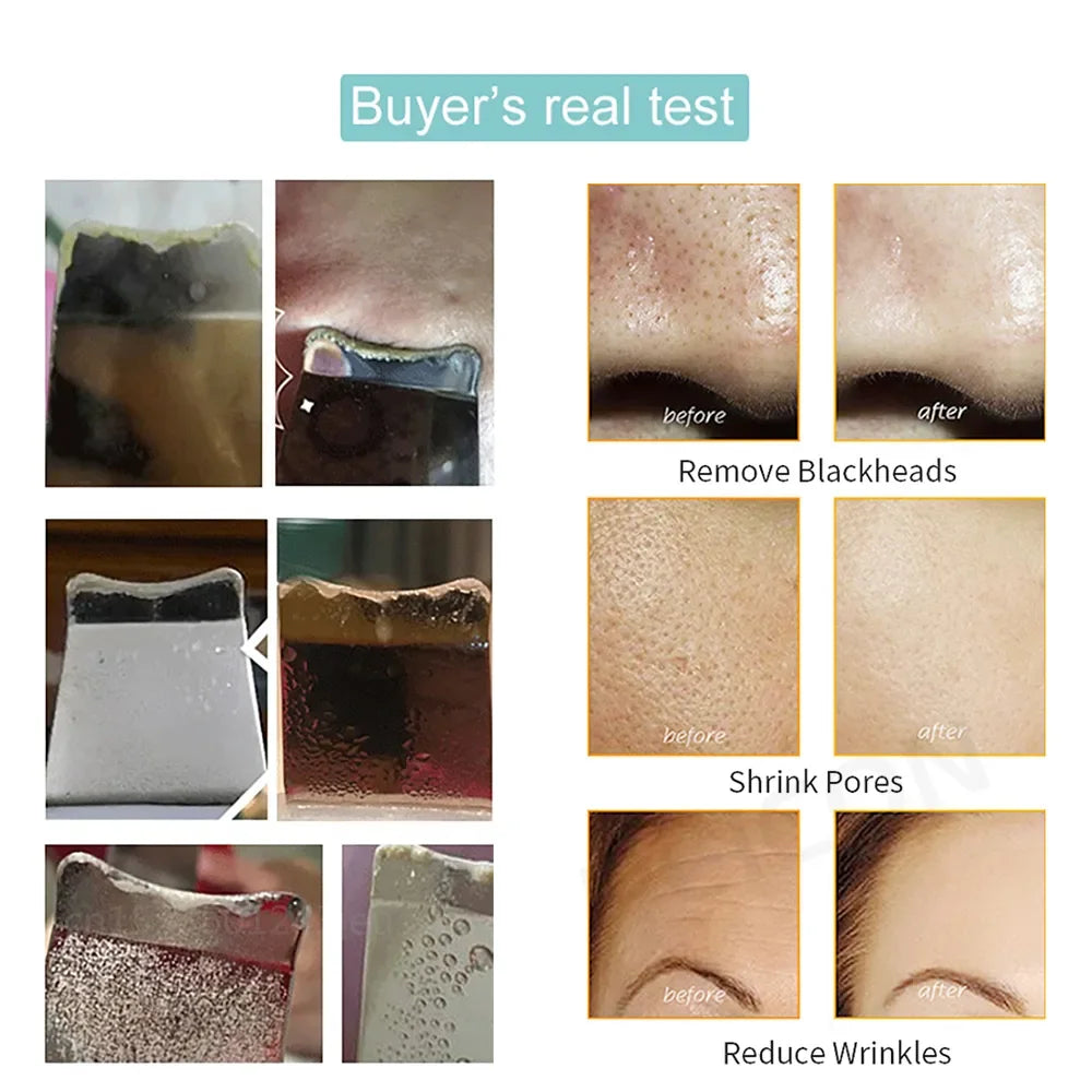 Ultrasonic Skin Scrubber LUXLIFE BRANDS